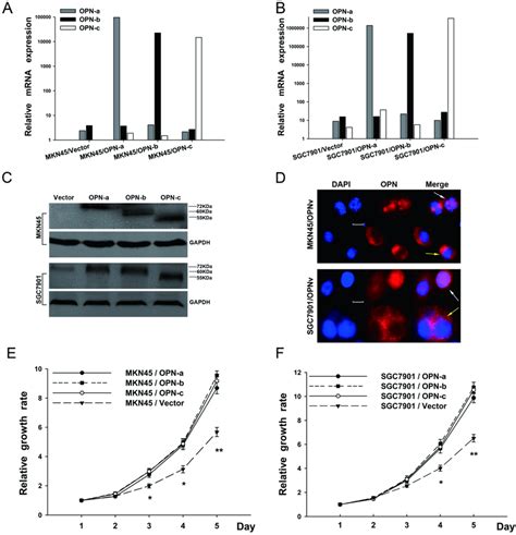 Overexpression Of Each Opn Splice Variant Promotes Gc Cell