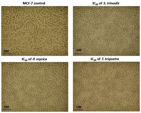 Morphological Alterations In Mcf 7 Cells After 48 H Of Treatment With Download Scientific