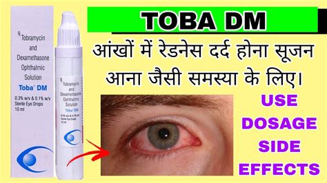 Toba Dm Eye Drop Uses In Hindi Tobramycin And Dexamethasone Opthalmic