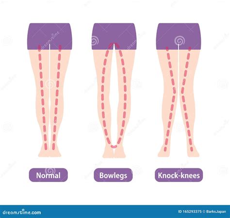 Les Types De Différence Des Angles Et Des Genoux De Jambes Dirigent L