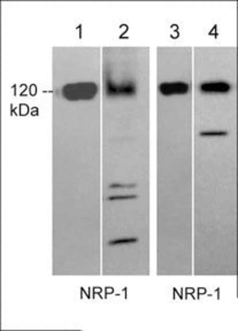 Neuropilin Monoclonal Antibody M Invitrogen L