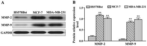 The Relationship Between Mmp 2 And Mmp 9 Expression Levels With Breast