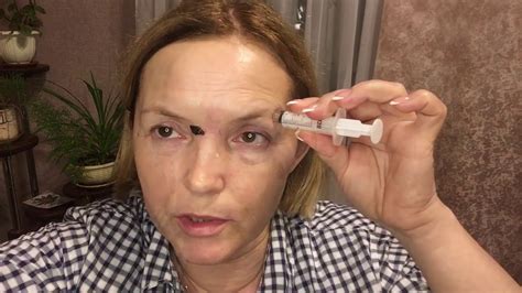 пиявки вместо уколов красоты - YouTube