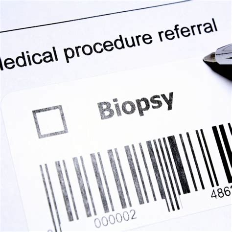 Understanding Transrectal Ultrasound Guided Prostate Biopsy A Vital Diagnostic Tool Prestige