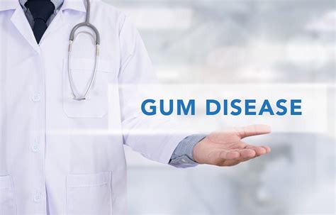 Gum Disease | Signs, Symptoms & Treatment Options