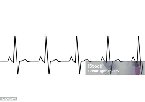 Grafik Denyut Jantung Detak Jantung Gelombang Ikon Ekg Warna Hitam Dan