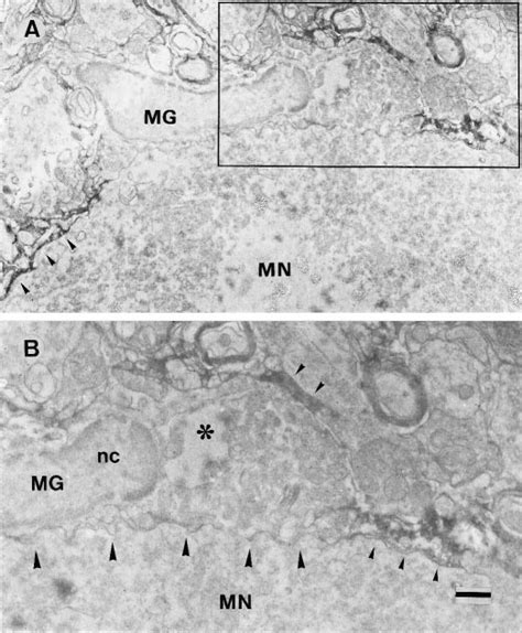 Immunoelectron Microscopic Analysis Of Tn R Expression In The