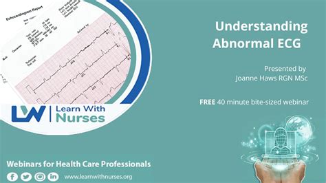 Understanding The Abnormal Ecg Learn With Nurses