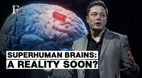 Neuralink Led By Elon Musk Achieves Milestone With Inaugural Human