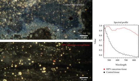 Enhanced Dark Field Hyperspectral Microscopy Control Cervical Tissue