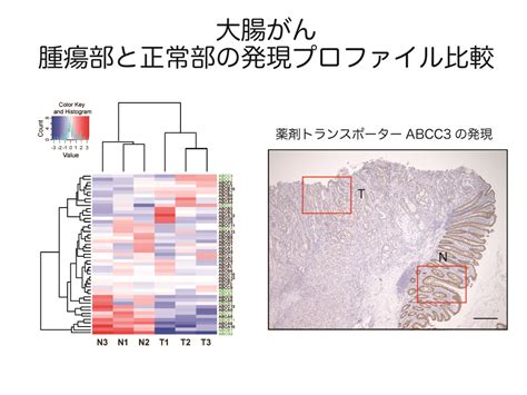 研究シーズ詳細情報（no127） 大腸がんにおけるabc トランスポーターの発現制御 東北大学 研究シーズ集