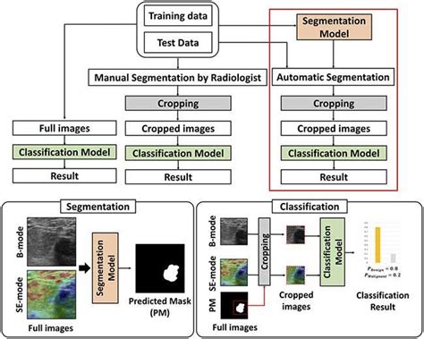 Detecting Breast Cancer With Ai Powered Ultrasound Imaging Innovation