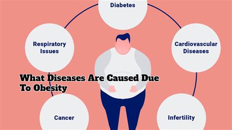 What Diseases Are Caused Due To Obesity Successyeti