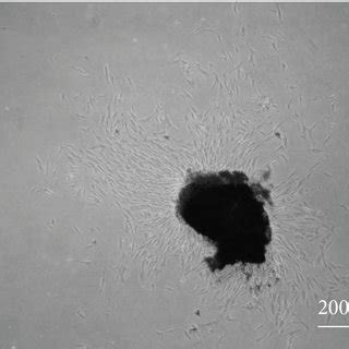 Culture Of Stem Cells From Apical Papilla A SCAPs Cell Primary