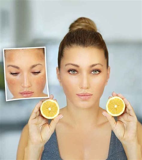 How To Use Lemon Juice For Dark Spots On Face 9 Natural Ways Dark Spots On Skin Dark Spots