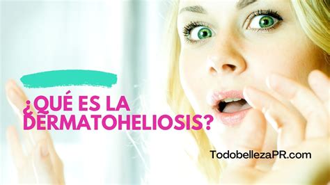 ¿Qué es la dermatoheliosis? - YouTube