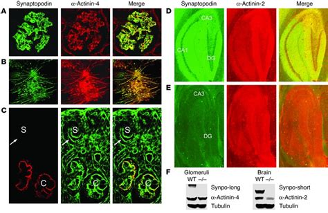 Jci Synaptopodin Regulates The Actin Bundling Activity Of Actinin