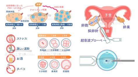 Webサイト用 体外受精の図説イラスト｜ぶちねこ堂