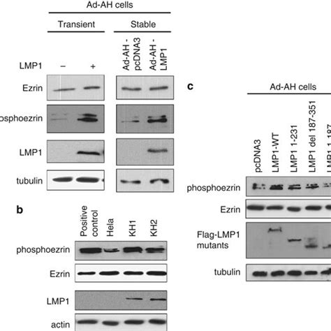 Lmp Increases Phosphorylation Of Ezrin In Nasopharyngeal Epithelial