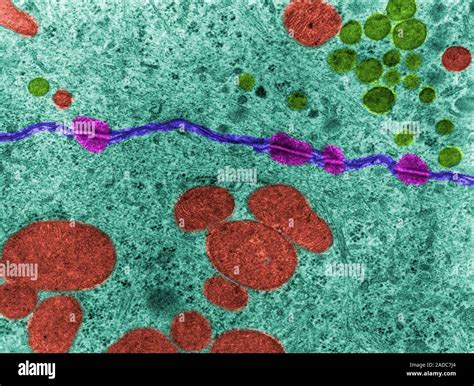 False Colour Transmission Electron Micrograph TEM Showing Several