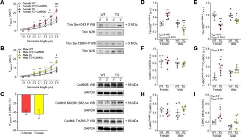 Sex Specific Cardiovascular Remodeling Leads To A Divergent Sex Dependent Development Of Heart
