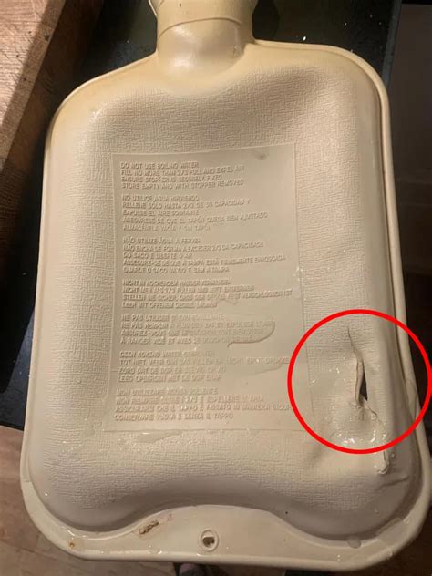 Mum Horrified As Daughter S Skin Melts And Bubbles As Primark Hot Water Bottle Spills Over Her