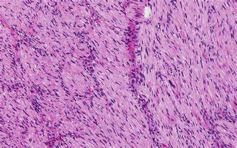 Pathology Outlines Case 329