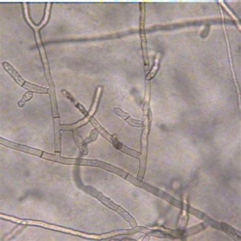 Rhizoctonia Root Rot Belly Rot