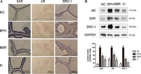 Frontiers Berberine Improves Benign Prostatic Hyperplasia Via