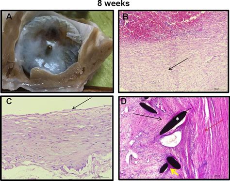 Histopathological Examination Of Device And Surrounding Tissue At