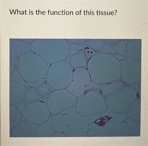 Solved What is the function of this tissue? | Chegg.com