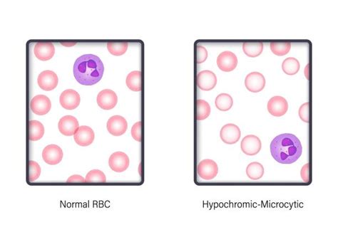 60+ Blood Smear Microscope Stock Illustrations, Royalty-Free Vector ...