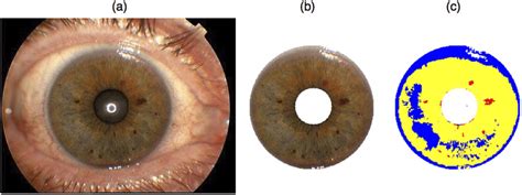 Example Of Fully Automated Iris Segmentation And Eye Colour