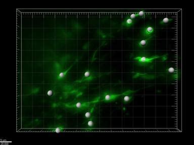Video: Preparation of Acute Slices from Dorsal Hippocampus for Whole ... 