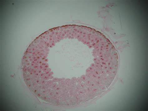 Blastula