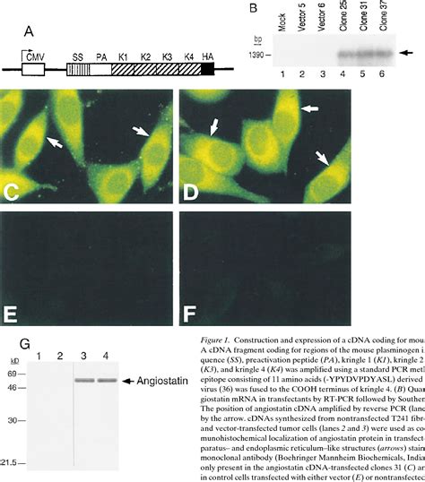 Figure From Expression Of Angiostatin Cdna In A Murine Fibrosarcoma