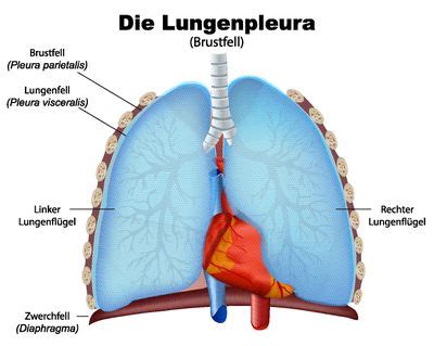 Pleuraerguss Ursachen Behandlung Hilfe MedLexi De