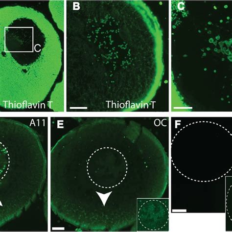 Xenopus oocytes contain nuclear and spatially localized cytosolic ... 