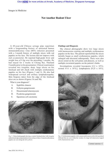 Not Another Rodent Ulcer—xiaotian Wu Et Al 417 Images In Medicine Docslib