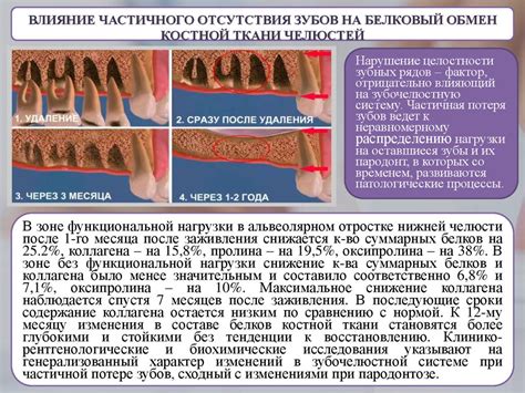 Биохимия костной ткани - online presentation