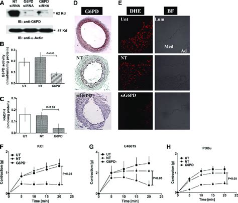 G Pd Knockdown Reduced Kcl And U Induced Ca Contraction A D