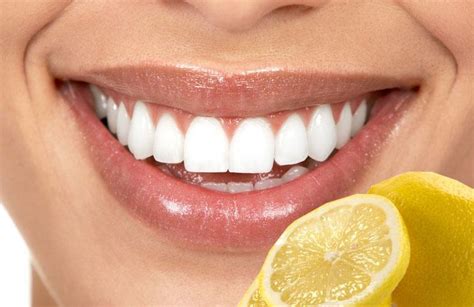 18 Most Effective Home Remedies for Teeth Whitening Everyone Needs to ...