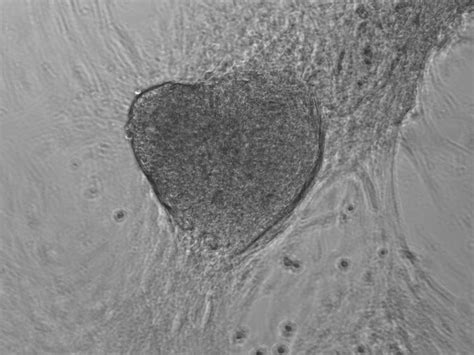 Generation Of Human Cardiomyocytes A Differentiation Protocol From