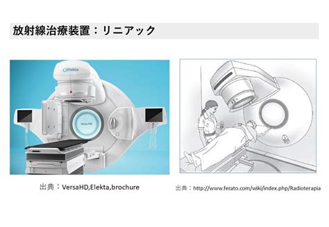 放射線治療は“がん治療の三本柱”の1つ｜放射線アカデミア
