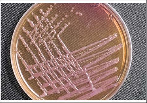 Non-lactose fermenting bacteria colonies on MacConkey agar exhibiting ...