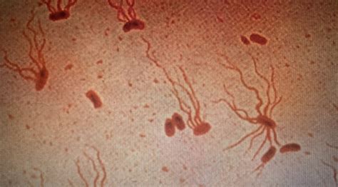 Environmental Transmission Of Bacterial Viral And Fungal Pathogens