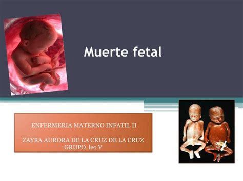 Muerte Fetal Enfermeria Para Ti Udocz