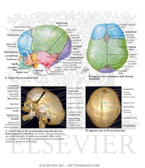 Anatomy Of The Newborn Cranial Sutures And Lateral And Off