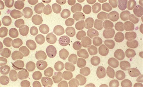 Babesia Apicomplexan Genus Britannica