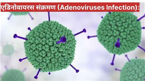 एडिनोवायरस क्या है और एडिनोवायरस संक्रमण क्या होता है Adenovirus